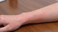 forearm irritation from desk